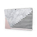 Alluring - Microsoft Surface Pro Skin - eZthings USA WE SORT ALL THE CRAZIEST GADGETS, GIZMOS, TOYS & TECHNOLOGY, SO YOU DON'T HAVE TO.