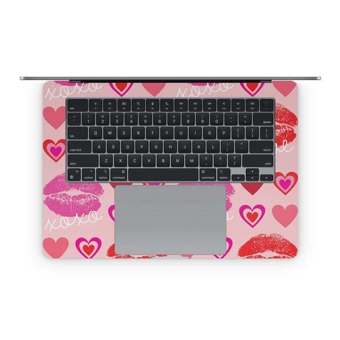 Love Hugs Kisses - Apple MacBook Skin